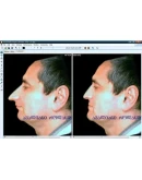 Виртуальная пластическая хирургия