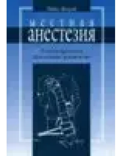 Местная анестезия