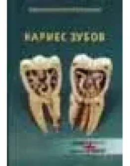 Кариес молочных и постоянных зубов в детском возрасте