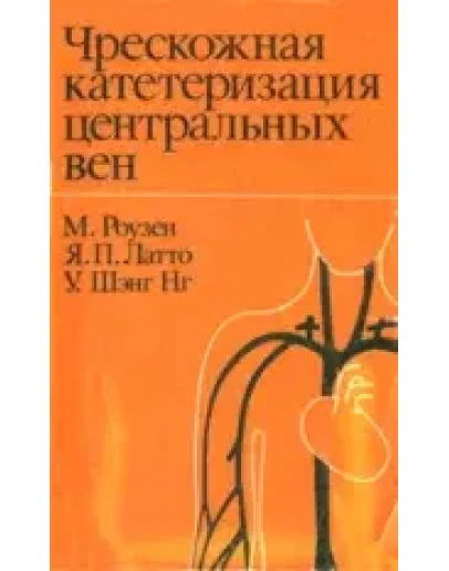 Чрезкожная катетеризация центральных вен