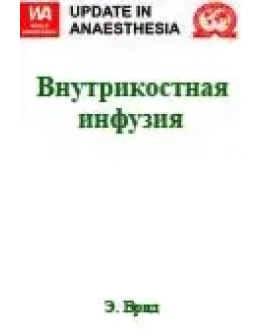 Внутрикостная инфузия