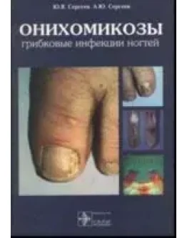 Oнихомикозы